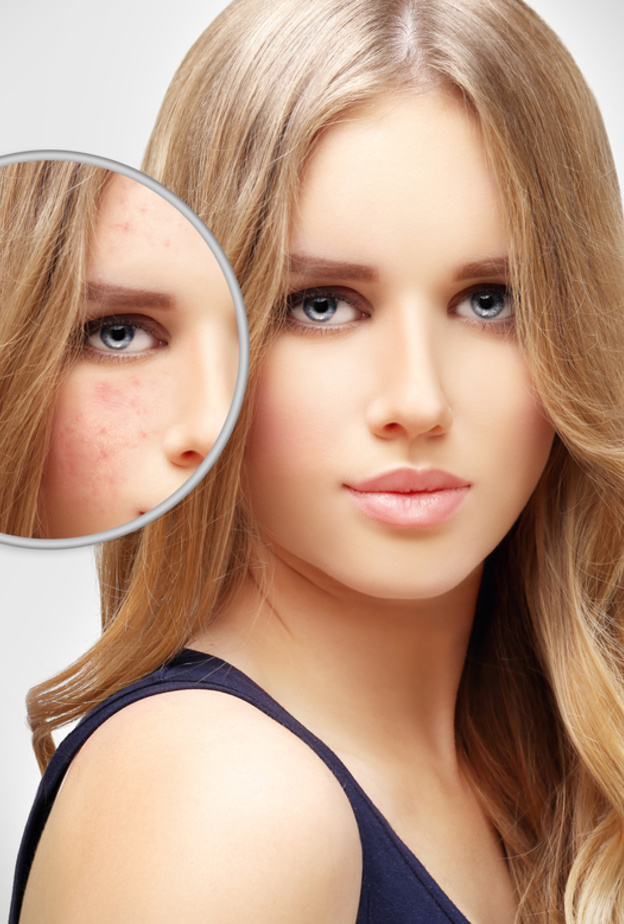 أفضل وصفات طبيعية لإزالة تصبغات الجلد