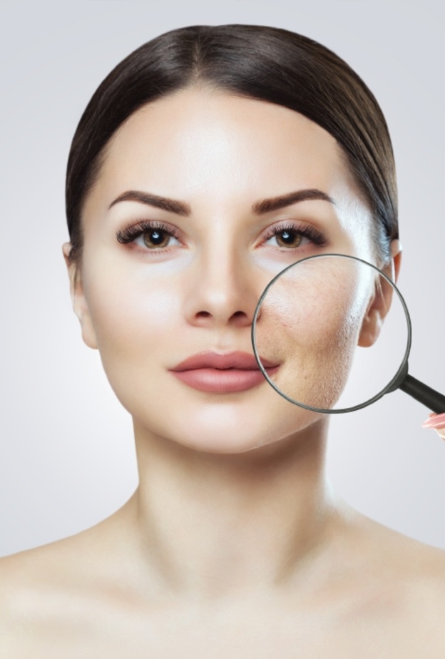  طرق علاج مسامات الوجه جراحياً وأهم نتائجها