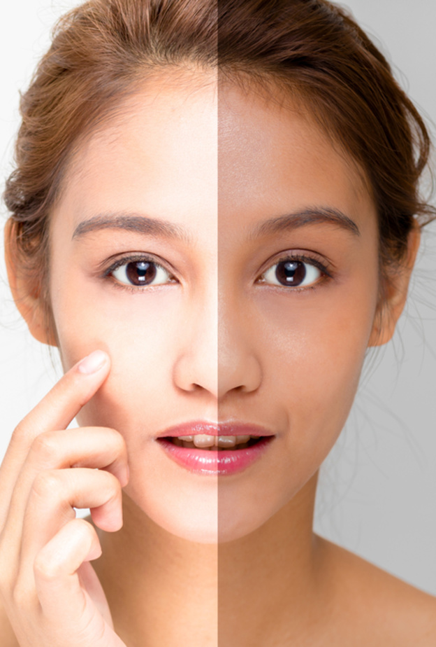 خلطات طبيعية لتفتيح البشرة السمراء قبل نهاية العام