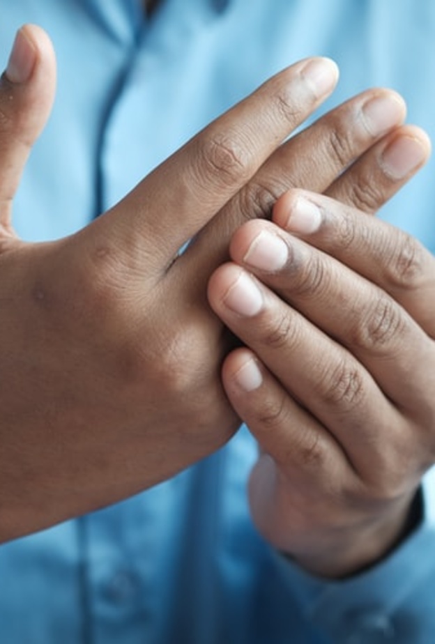 عرض جديد يسببه فيروس كورونا يظهر على الجلد والأظافر والشفاه