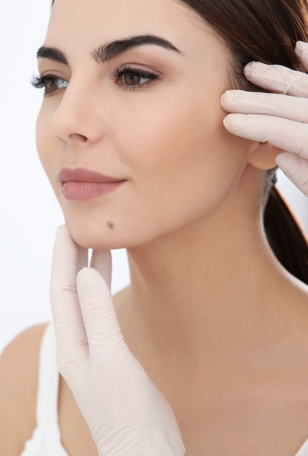  كيف تتم إزالة الشامة من الوجه وأفضل الطرق