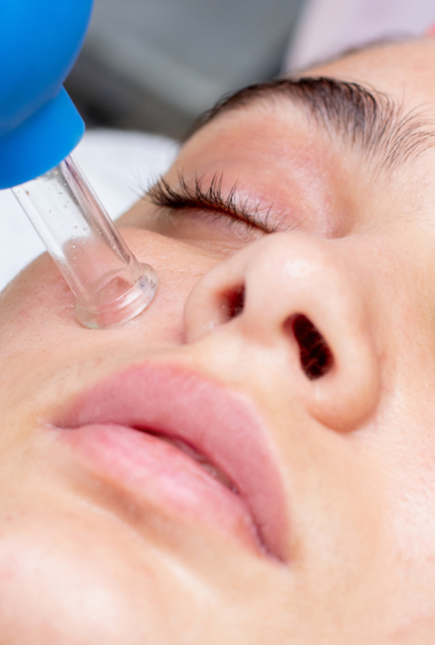 طريقة عمل الحجامة للوجه وأهم النصائح عند تطبيقها