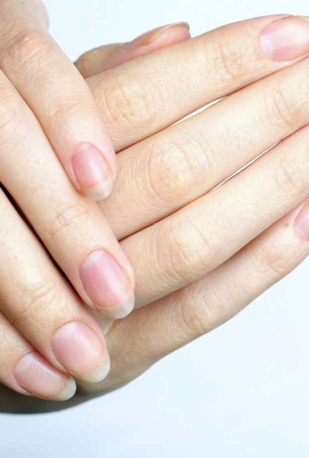 فوائد زيت اللبان لتقوية الأظافر الضعيفة والهشة