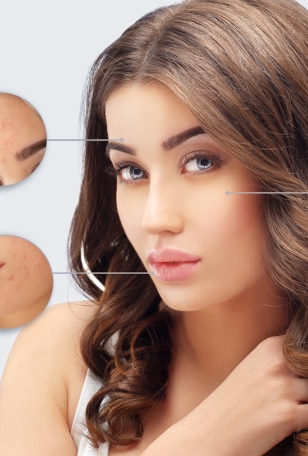  أفضل الطرق لعلاج ندبات حب الشباب نهائياً