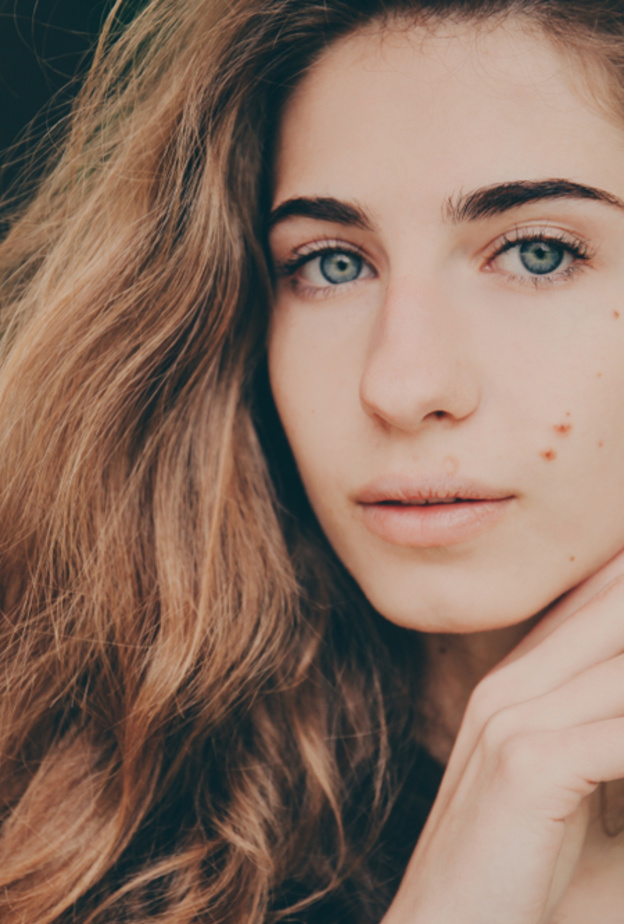 تقنيات لازالة العلامات الخلقية