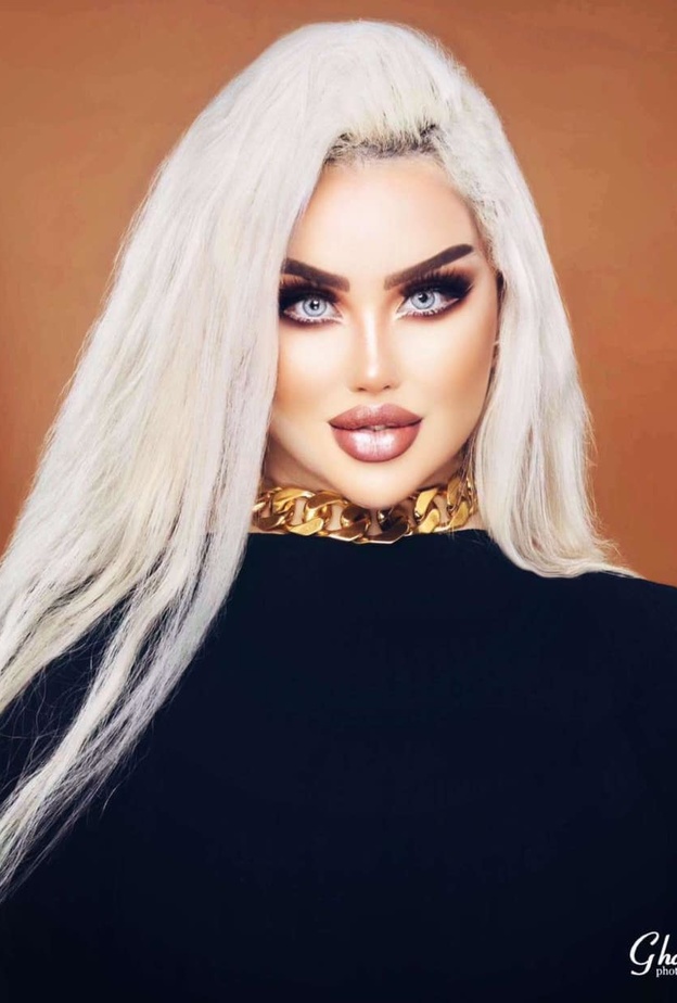 العراقية داليا نعيم تخضع للمزيد من عمليات التجميل