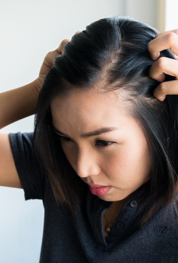 6 نصائح ذهبية تقلل من مشكلة تساقط الشعر للمصابين بالغدة الدرقية-رئيسية واولى