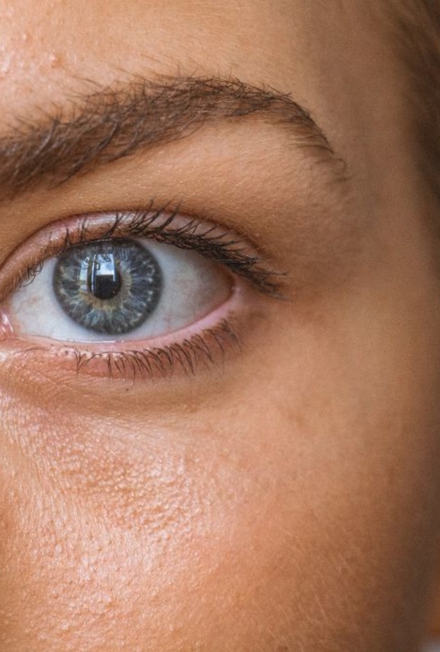 أسباب ازدواج الرؤية وطرق العلاج