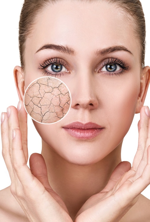 نصائح وطرق طبيعية لتنظيف البشرة الجافة