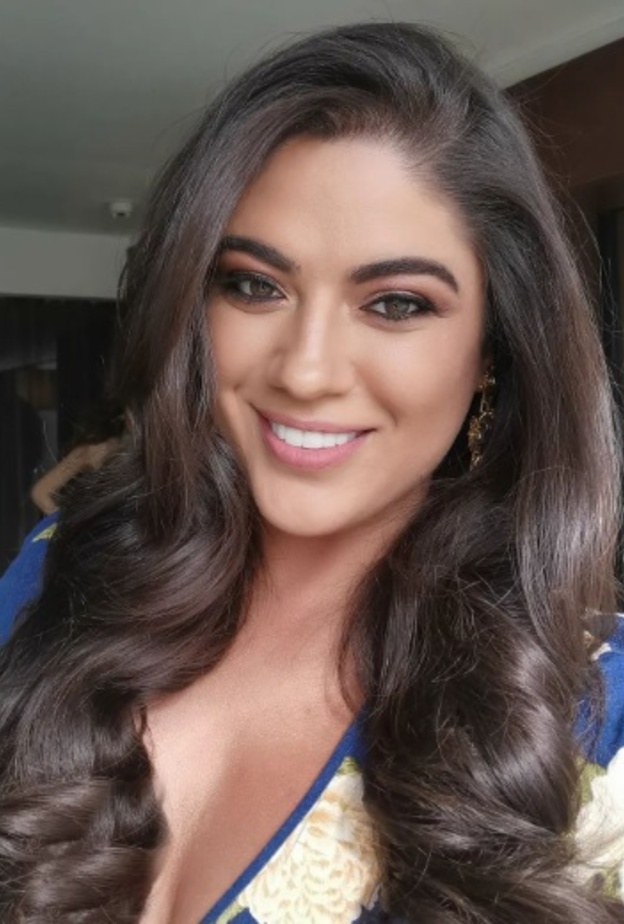  نادين ويلسون نجيم تطل بجرأة بدون فلتر وتكشف عن عيوب بشرتها