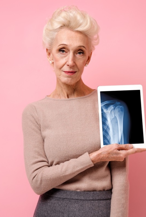 نصائح لحماية الكتلة العظمية عند النساء