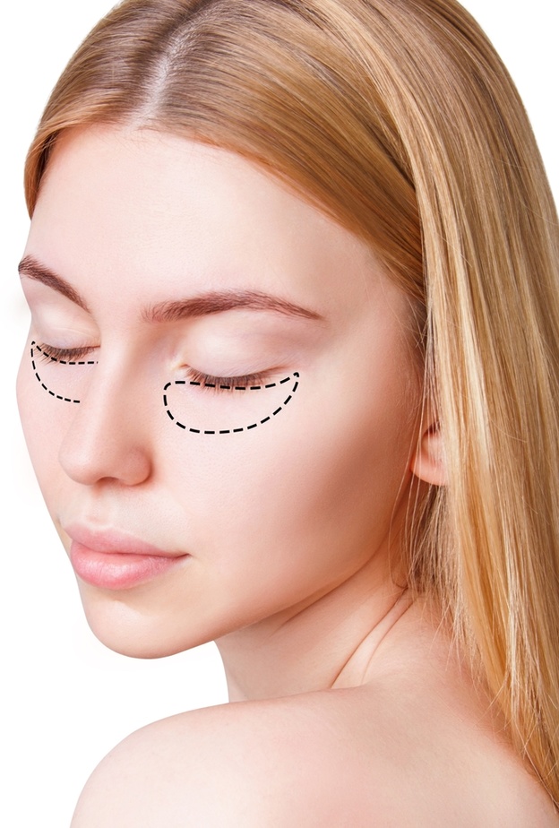 نصائح وأهم التعليمات قبل وبعد حقن الفيلر تحت العين