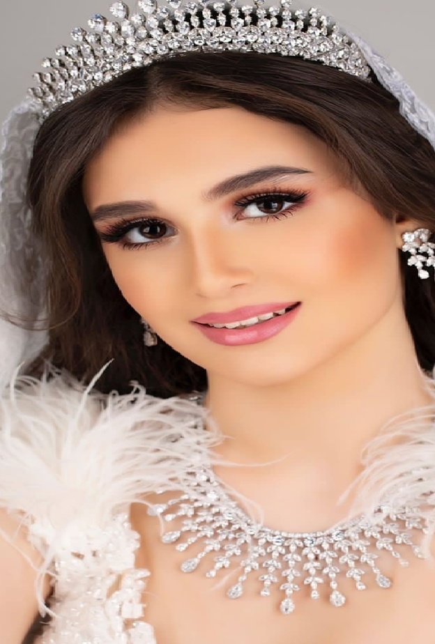 بعد الفستان الأبيض .. 5 حقائق مهمة عن الزواج لن يخبرك بها أحد