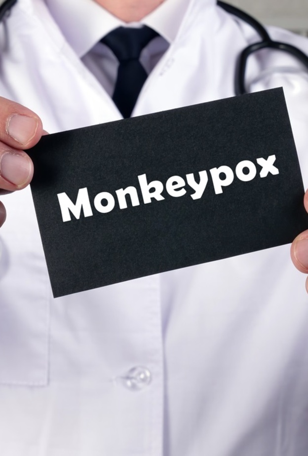 جدري القرود .. يستدعي المتابعة ويمكن الوقاية منه بطرق بسيطة