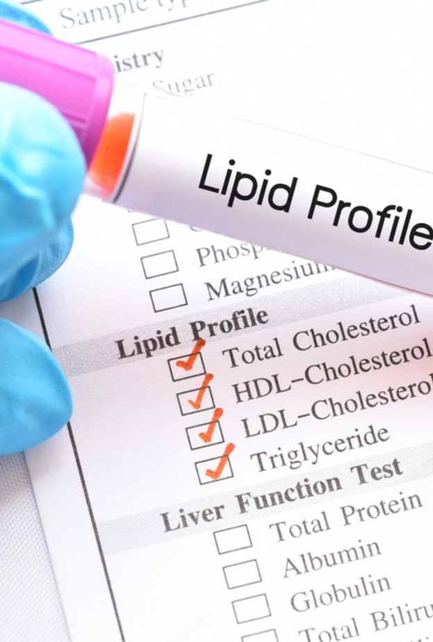 ما هو فرط شحميات الدم وكيف يمكن الوقاية منه