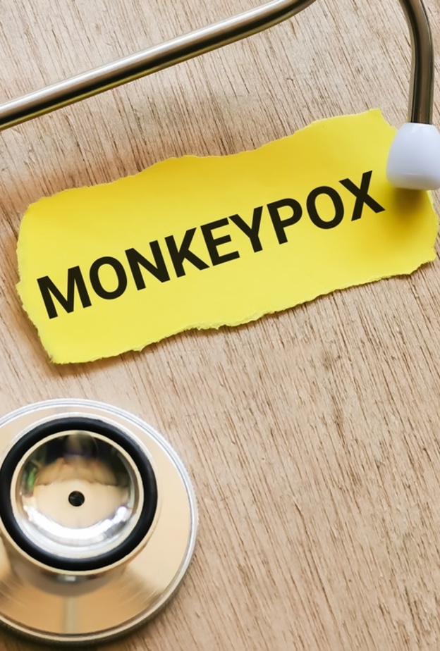 مرض جدري القردة مرض نادر