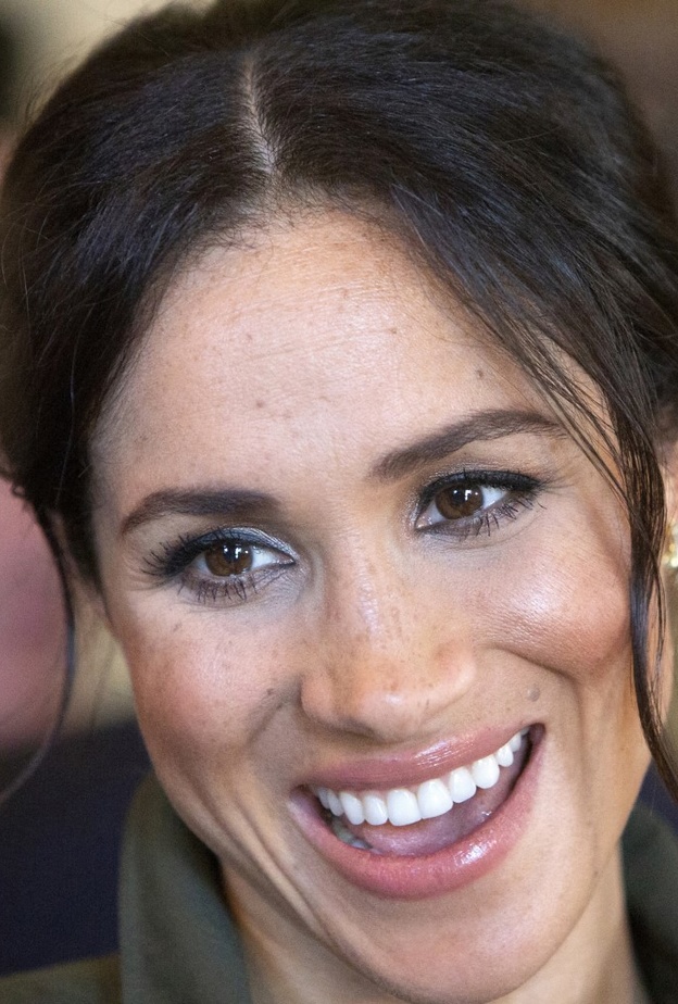 هل خضعت ميغان ماركل لعملية تجميل في أسنانها؟