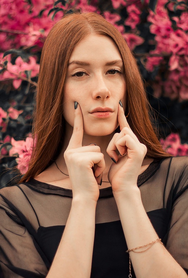 مميزات حقن فيلر الخدود وماهي تقنياته وأفضل أنواعه