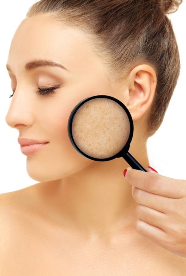 تصبغات الجلد مشكلة يمكن علاجها بالادوية والليزر