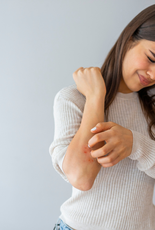 أعراض تدل على إصابتك بالتهاب الجلد التماسي