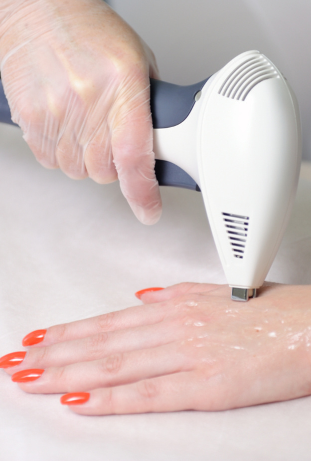 ما هي تقنيات الليزر المتنوعة لتقشير اليدين ونتائجها؟