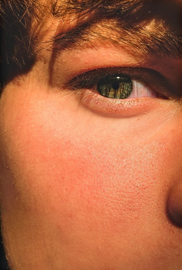 طريقة عمل ماسك اليار والبابونج مذهلة لعلاج الهالات السوداء في اسرع وقت