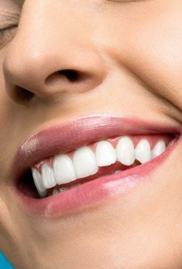 إحصلي على أسنان بيضاء قبل حلول عيد الأضحى بوصفات طبيعية سريعة