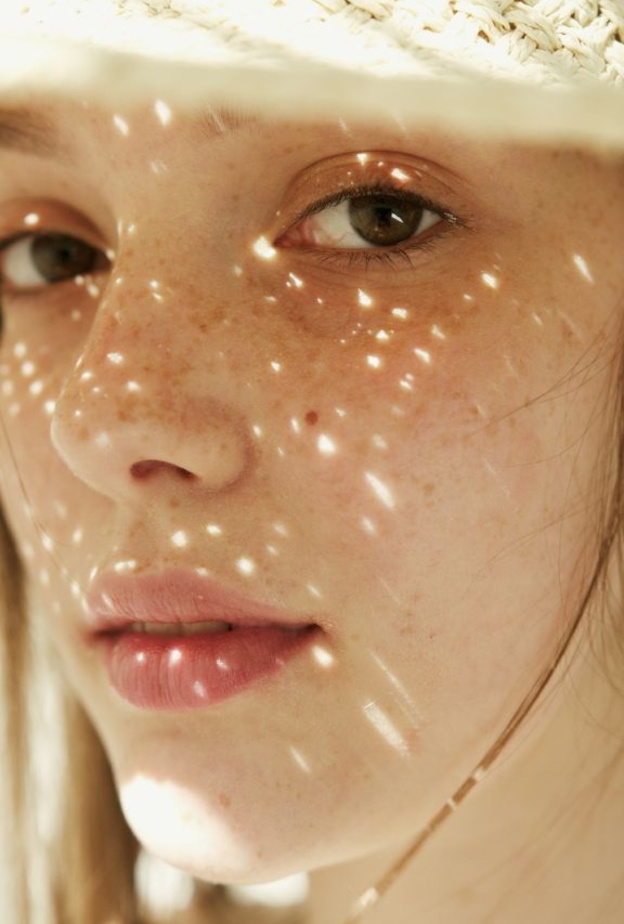 إزالة النمش والكلف في الصيف بالطرق الطبيعية وطريقة استخدامها