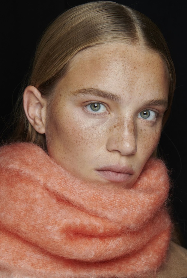 طرق إزالة النمش من الوجه مع بداية موسم الخريف