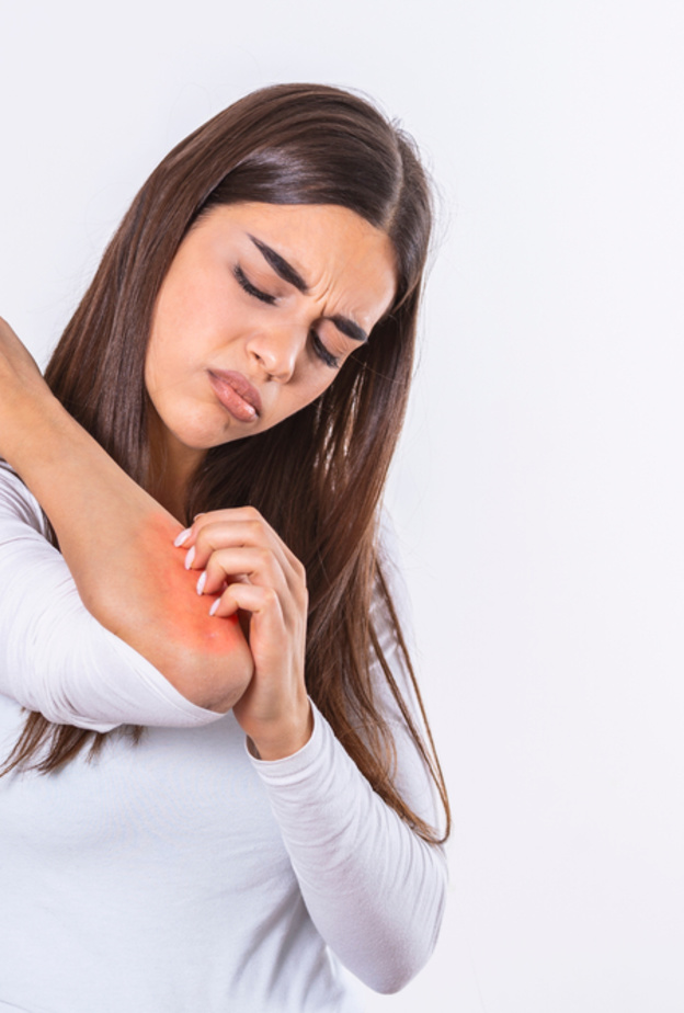 ماهي أسباب الطفح الجلدي الحراري في الشتاء وكيف يمكن الوقاية منه