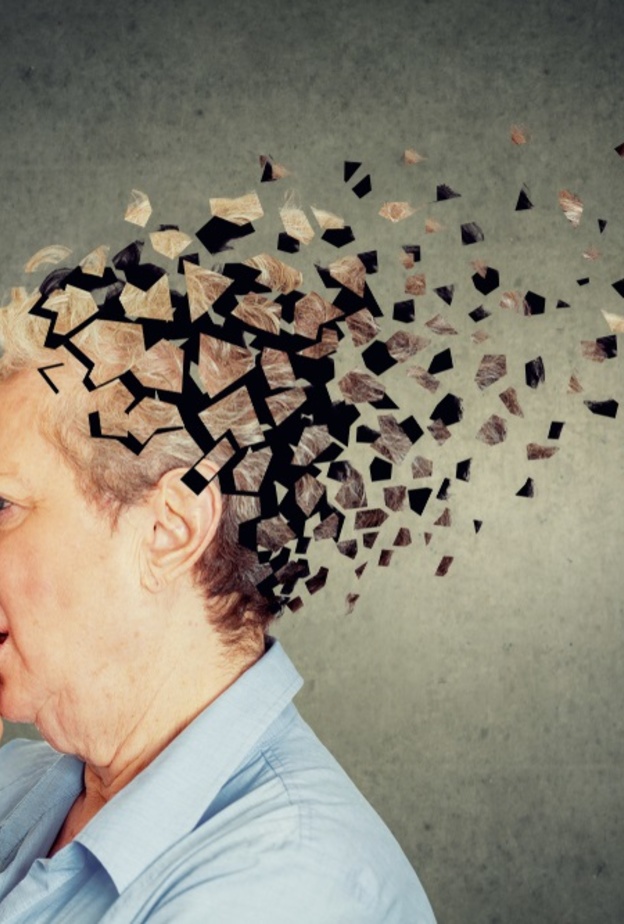 الزهايمر مرضٌ يعيق التفكير والذاكرة.. والتقنيات الحديثة تسعى لعلاجه بطرق فعالة