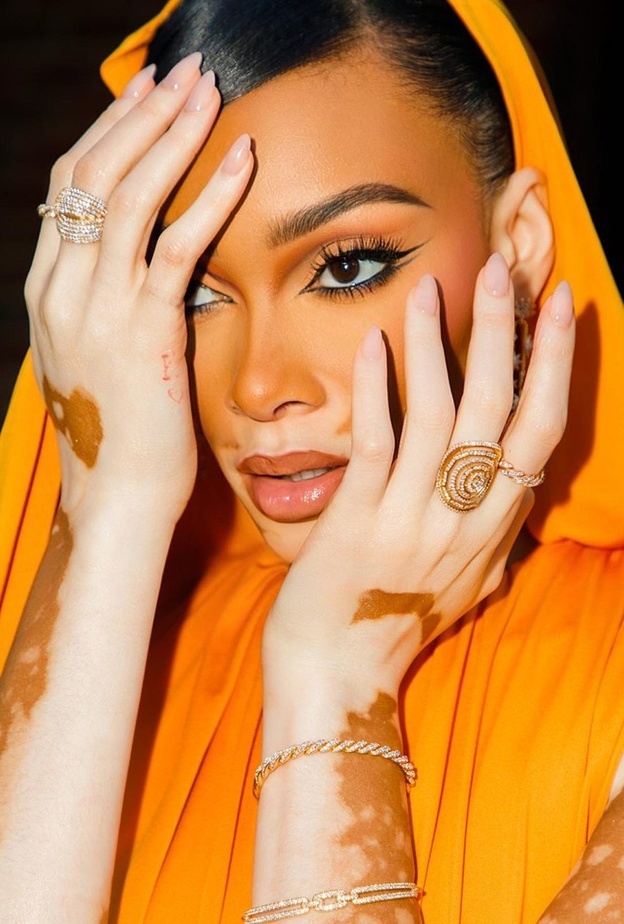 ويني هارلو Winnie Harlow من أشهر عارضات الأزياء حول العالم.. ماذا تختار تصاميم مجوهرات لتٌزيين إطلالاتها؟ 