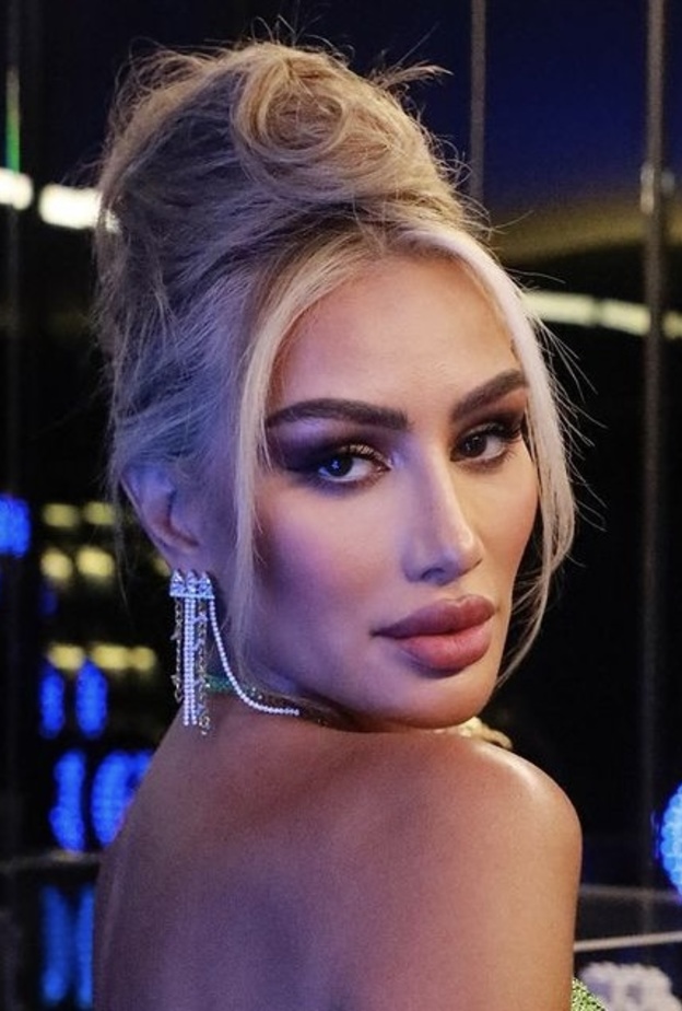 مايا دياب بعد خضوعها لحقن الشفاه الروسية
