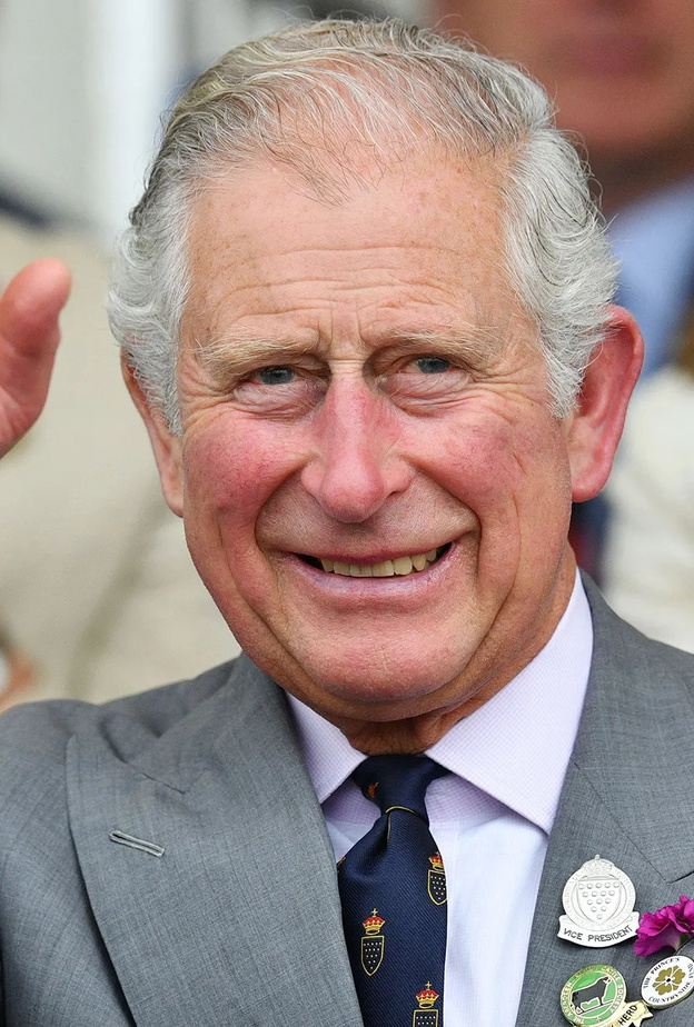 السبب الطبي وراء تورم أصابع الملك تشارلز