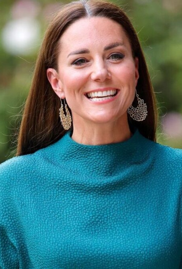 إصابة الأميرة كيت ميدلتون بالسرطان قد تنهي الخلاف الملكي قريبًا
