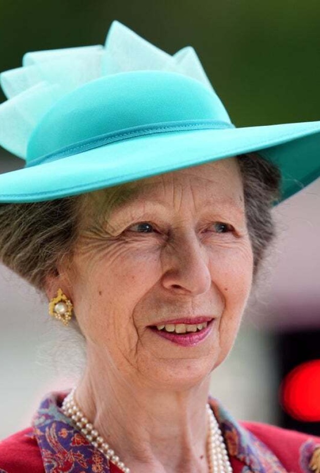 الأميرة آن تتعافي ببطء