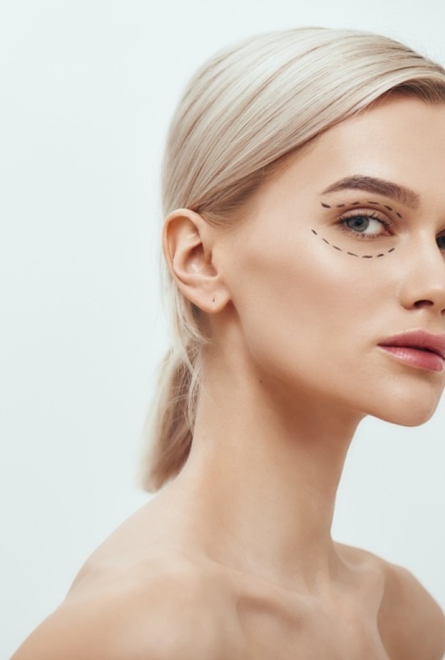 نتيجة حقن الفيلر تحت العين 