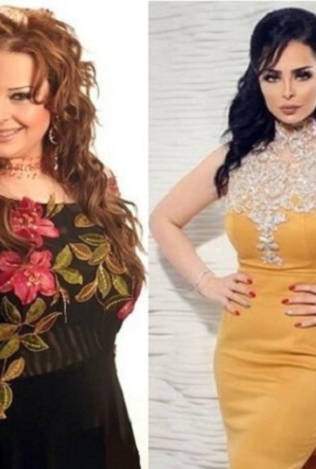 ديانا كرزون قبل وبعد التخسيس