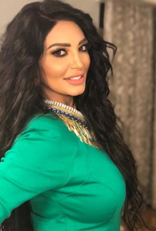 سالي عبد السلام تصاب بالصلع