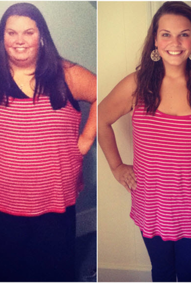 صورة توضح ماري قبل وبعد العملية الجراحية التي افقدتها نصف وزنها