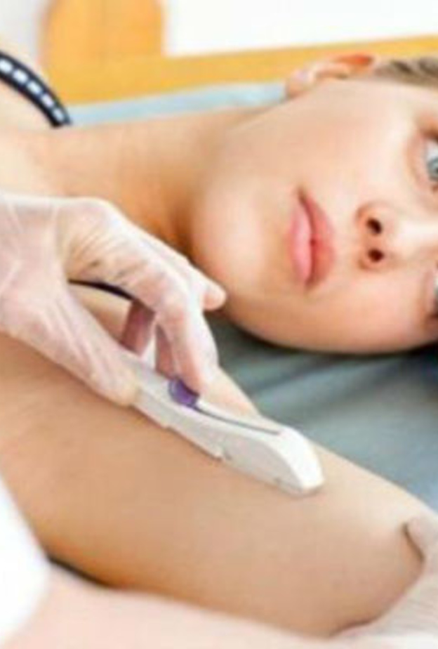 تركيب الغرسة