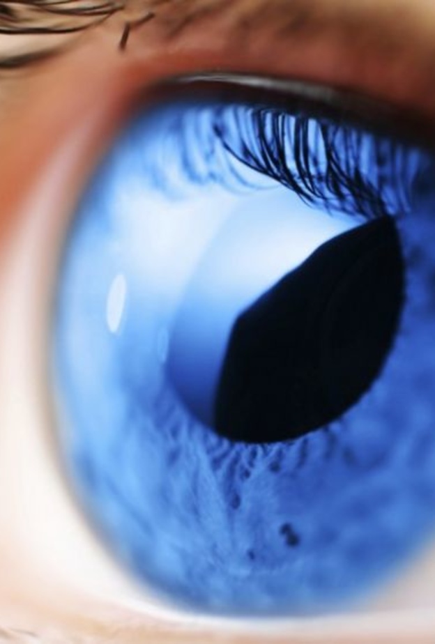 الجلوكوما هو السبب الثاني للعمى في العالم