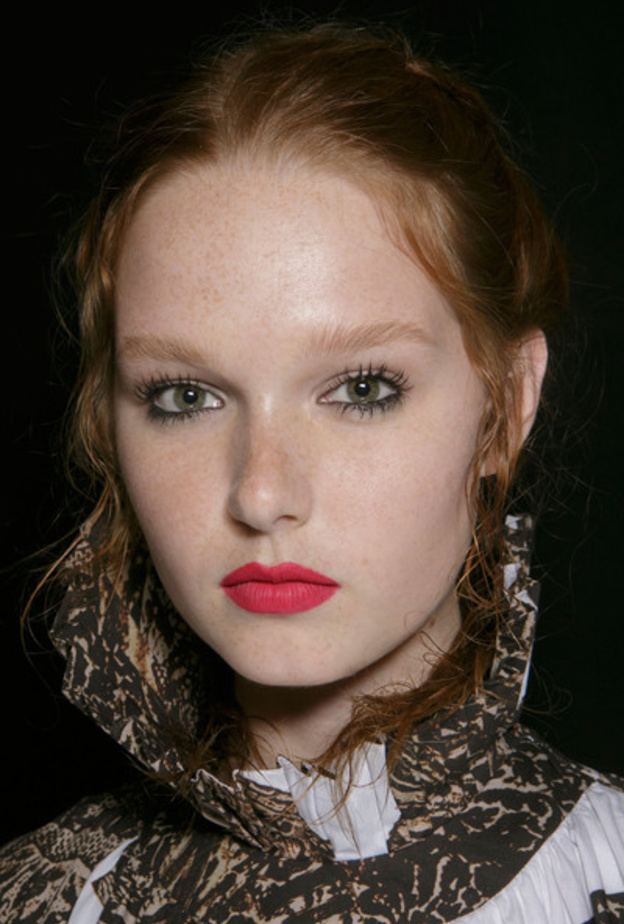 الحمرة البارزة والناشفة أيضاً حاضرة