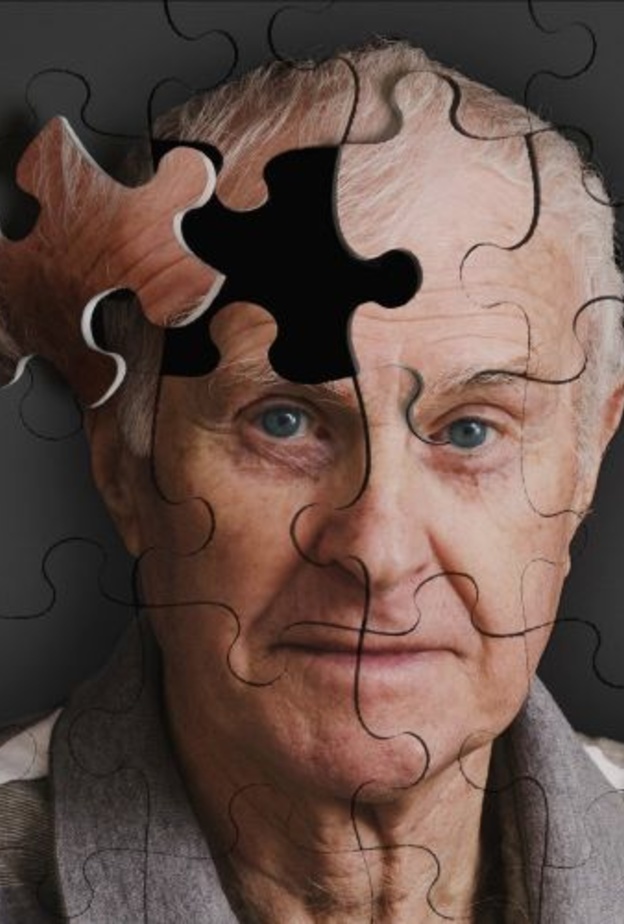 العلاج قد يقضي على الزهايمر 