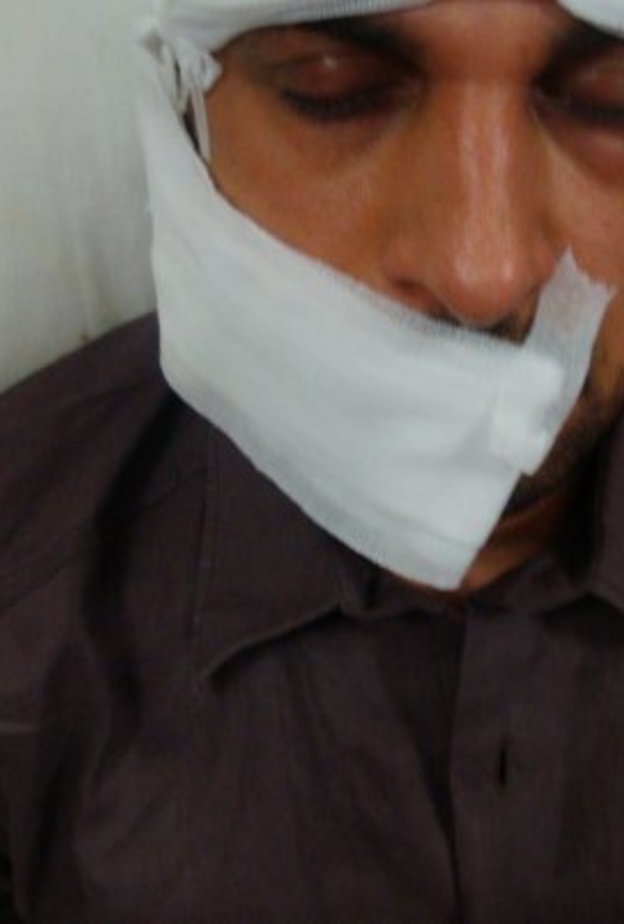 ماجد المهندس نجى من حادث السير بأعجوبة