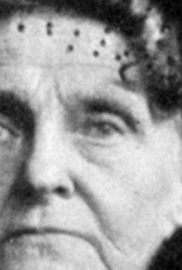 أبخل إمرأة في العالم .. مليونيرة ضحت بساق ابنها! 