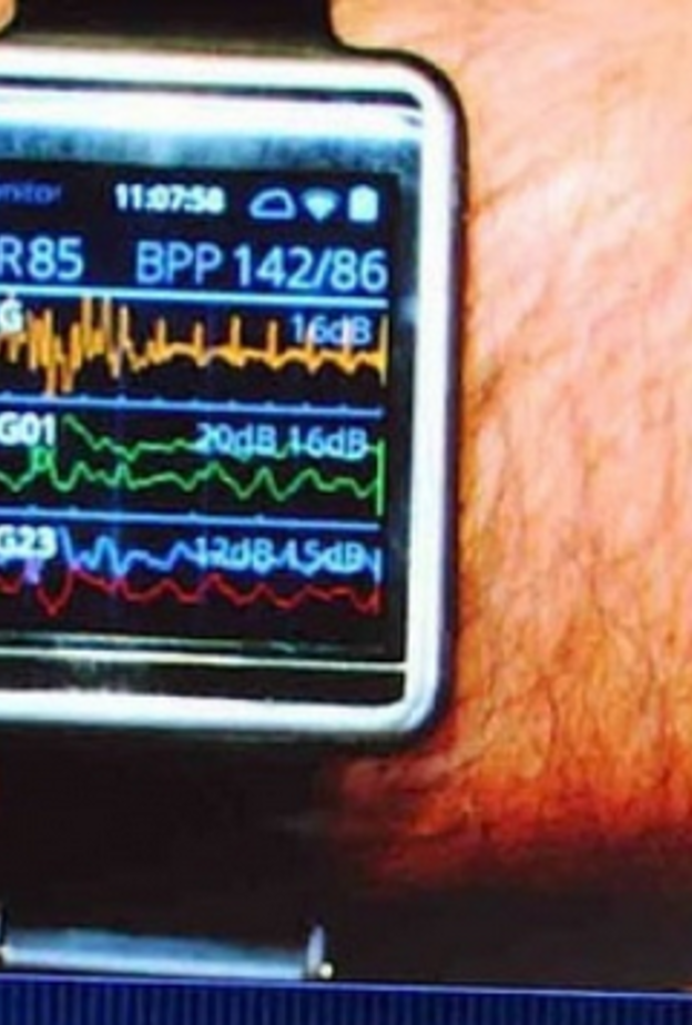 ساعة ذكية طبية