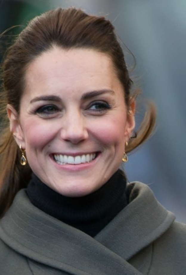 كيت ميدلتون قبل البوتكس