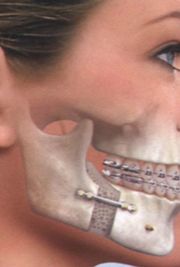 جراحة الفكين