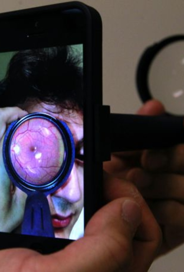 إفحص نظرك بهاتفك الذكي